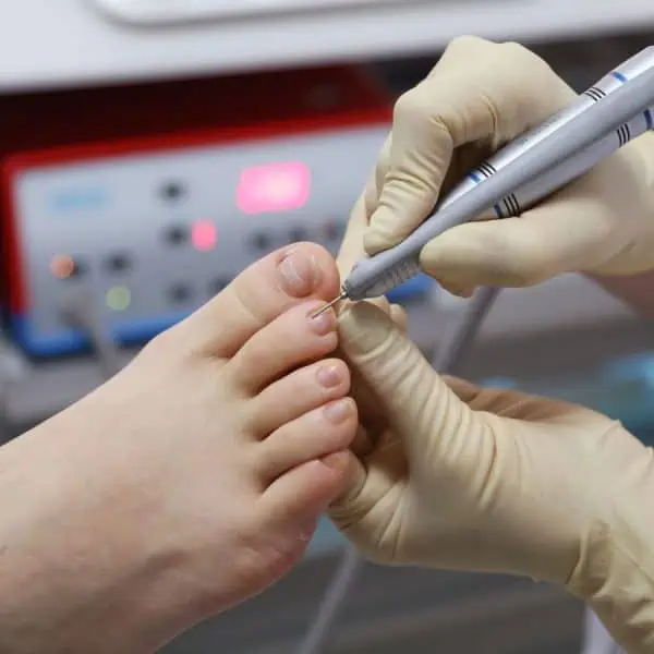 Podiatre assurant la gestion des ongles et des soins des pieds pour un patient diabétique.