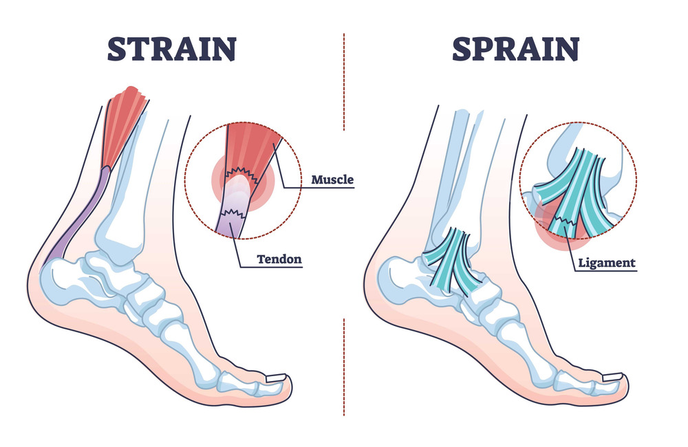 blessure aux ligaments du pied